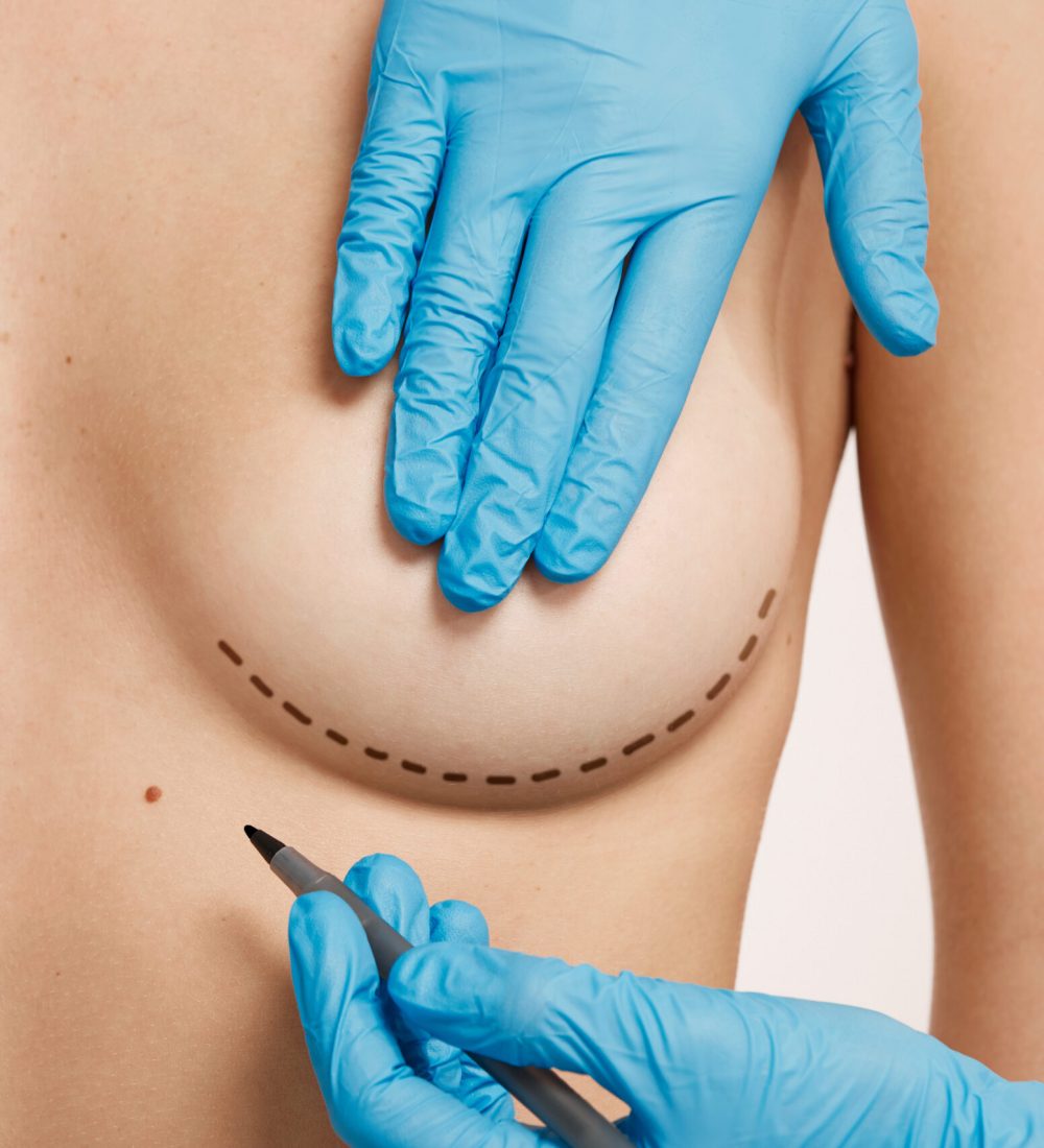 Beautiful woman with plastic surgery, depiction, plastic surgeon hands. Cosmetic surgery concept