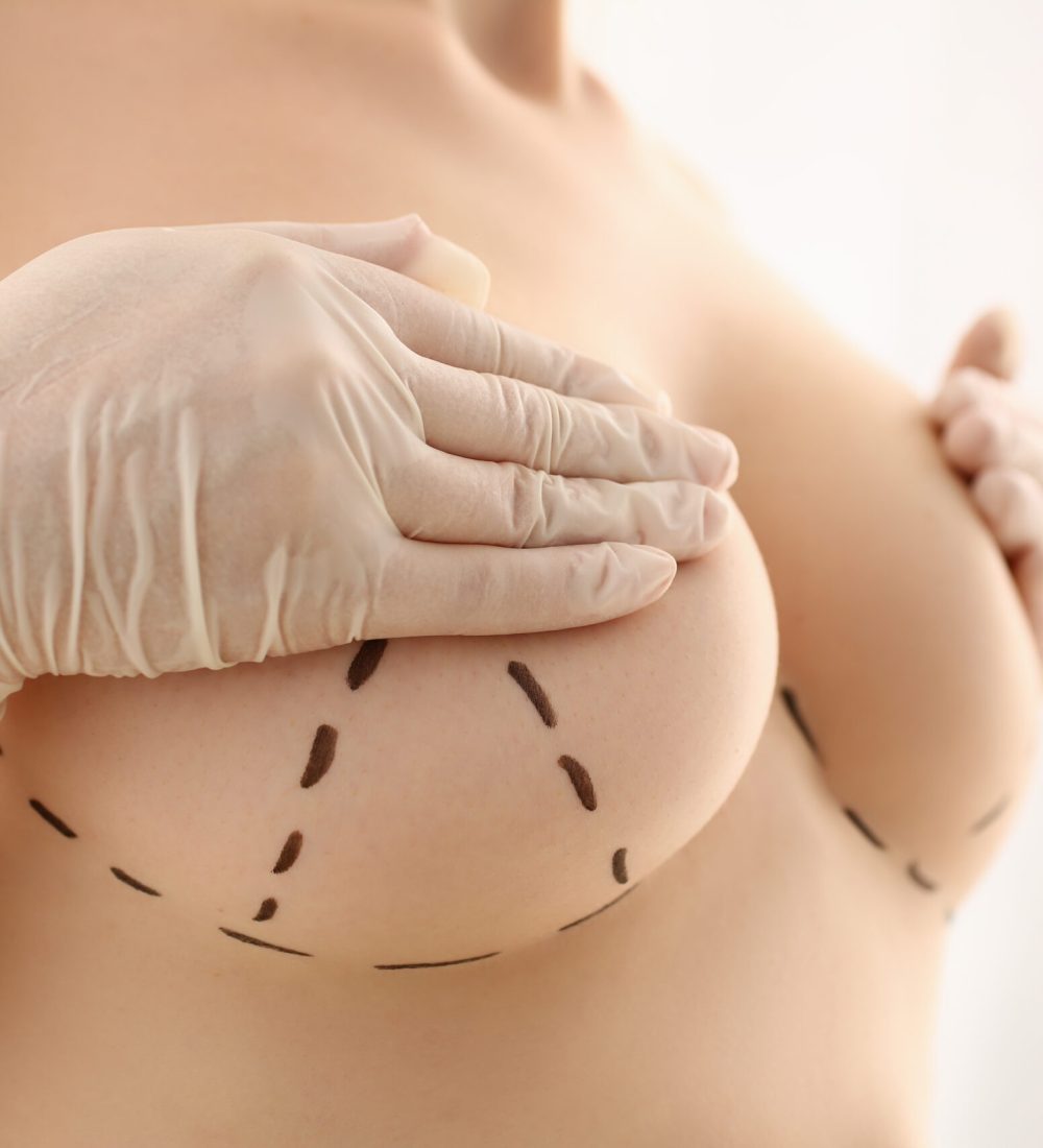 Naked female patient covering nipples with hands